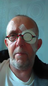 netvlies scheuring, oog laseren, laseren na scheuring netvlies, UMC Maastricht, funs lemmens, Marfan Sundroom