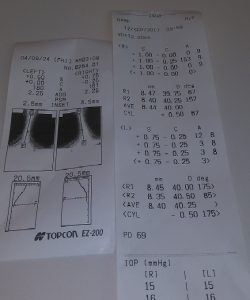netvlies scheuring, oogheelkunde UMC Maastricht, funs lemmens, marfan syndroom, oogmeting, laseren netvlies