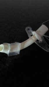 cuff 7 mm leeg, marfan syndroom, thuisbeademing, funs lemmens,