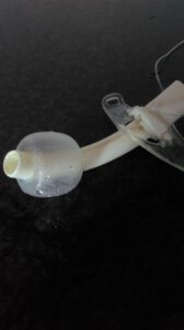 cuff 7 mm vol lucht, marfan syndroom, thuisbeademing, funs lemmens,