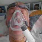 slapend met BPAP Masker, funs lemmens, marfan syndroom, opname IC MUMC