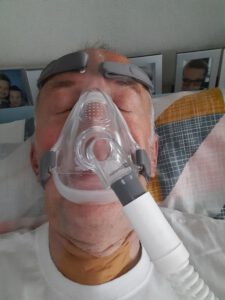 slapend met BPAP Masker, funs lemmens, marfan syndroom, opname IC MUMC