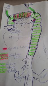 Uitslagen longarts en vaatchirurg, funs lemmens, aorta, bocht,